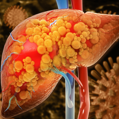 Evolving Treatment Paradigms in Hepatocellular Carcinoma: Applying the Latest Evidence in Rural and Underserved Communities